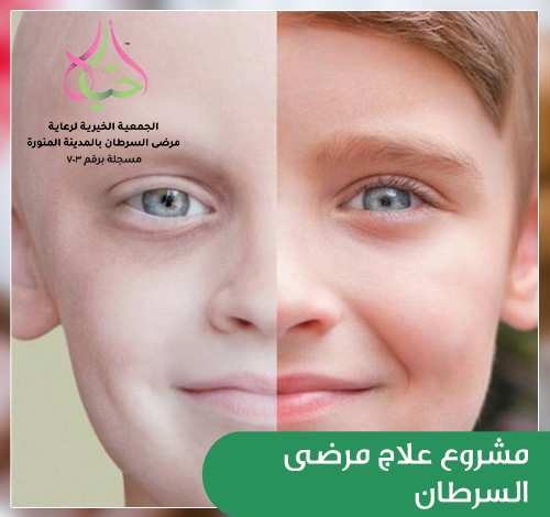 مشروع علاج المرضى